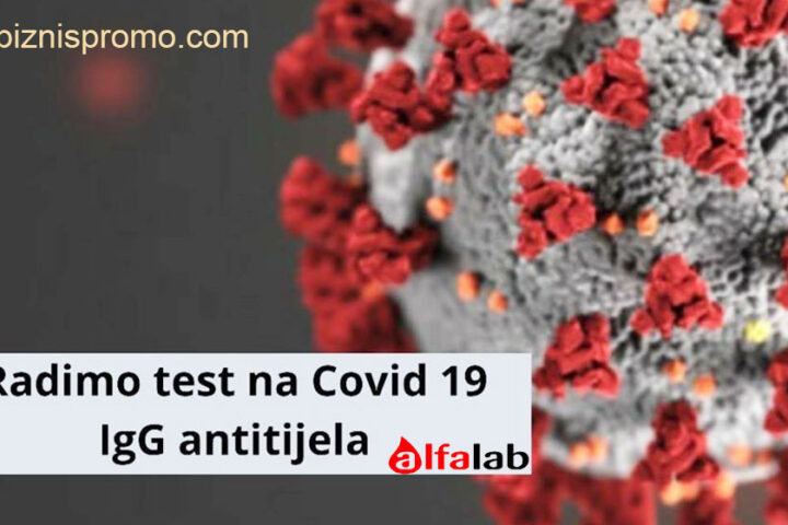 biznispromo-alfalab-laboratorije-test-na-covid-19-korona-virus