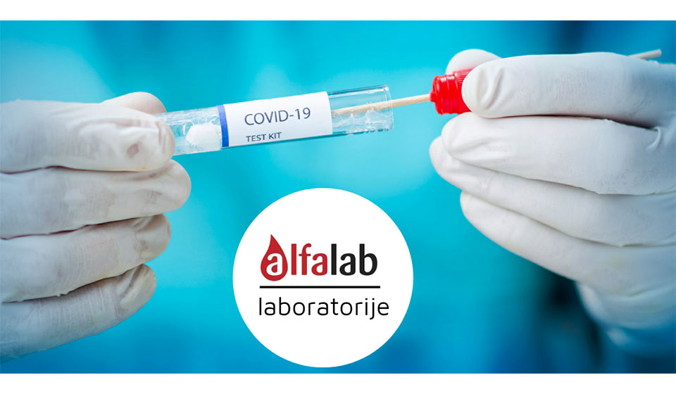 alfalab-laboratorije-test-antitijela-covid-19-korona-virus-itd-marketing-biznispromo-i-gradski-magazin